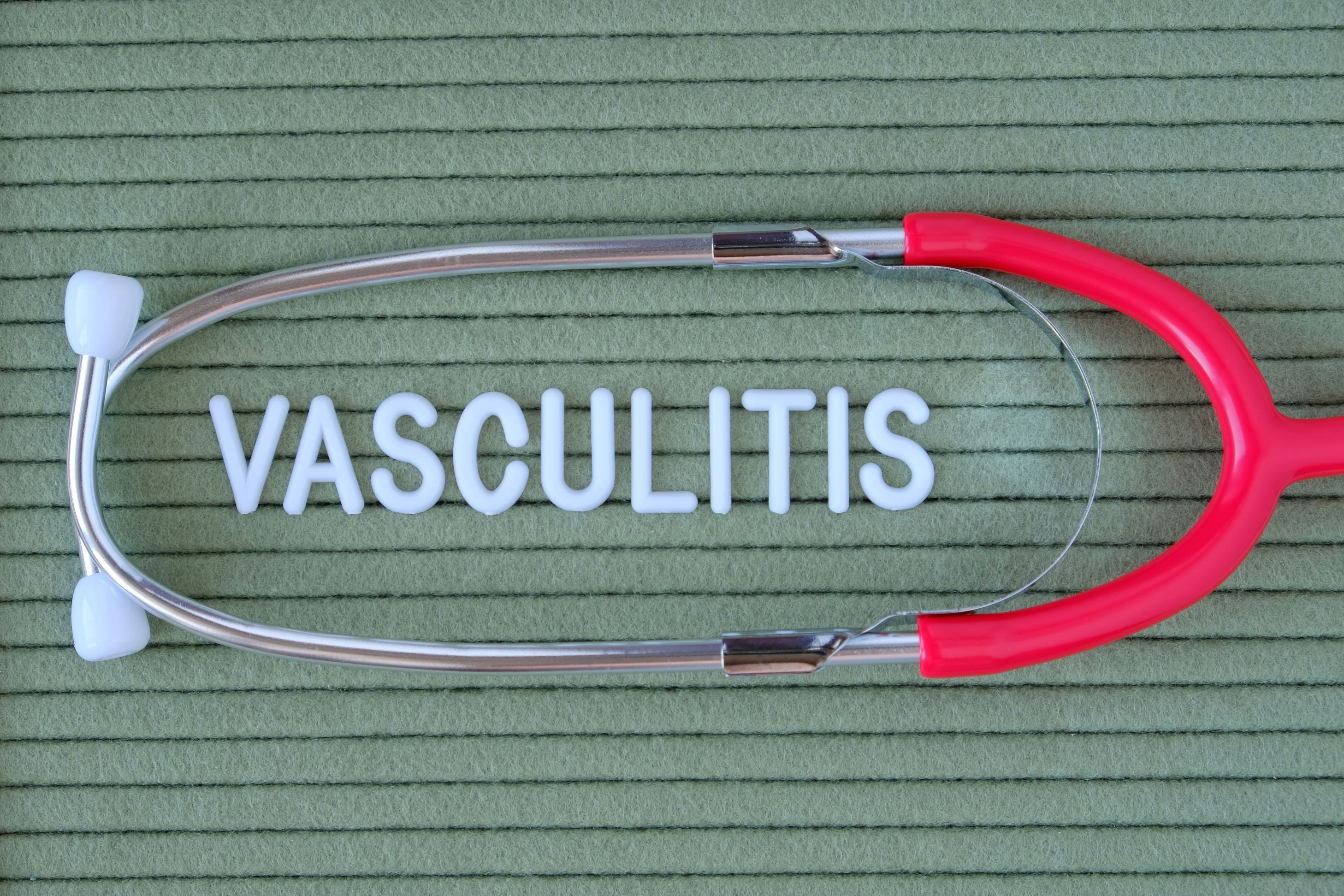 Vasculitis Vasculitis