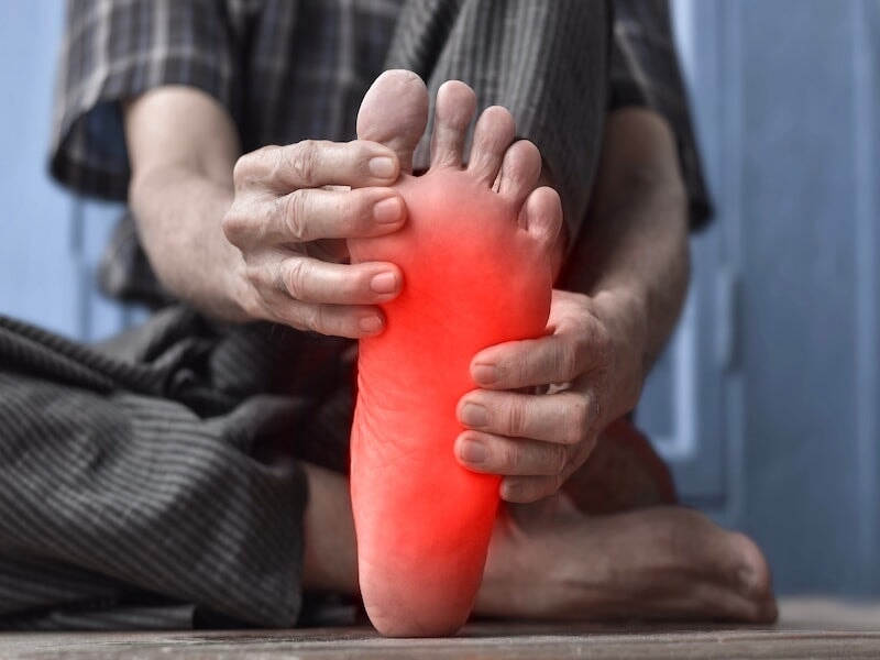 Sensory neuropathy in the foot