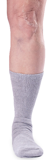 Gray sock worn on a standing foot