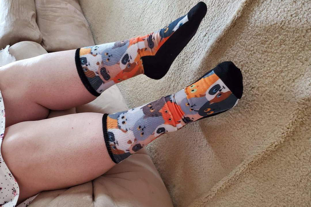 Legs of a lady wearing cat diabetic socks