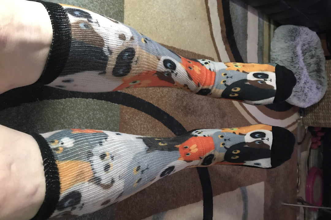 Legs of a lady wearing cat diabetic socks